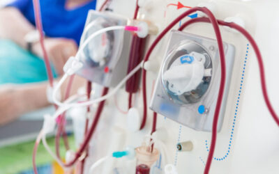 Dialysis Options: Making the Right Choice