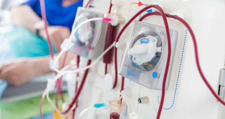 Dialysis Options: Making the Right Choice