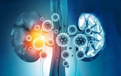 All you need to know about chronic kidney disease and its treatment