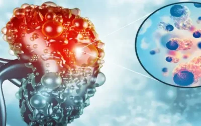 What are the symptoms of kidney problems or disease?