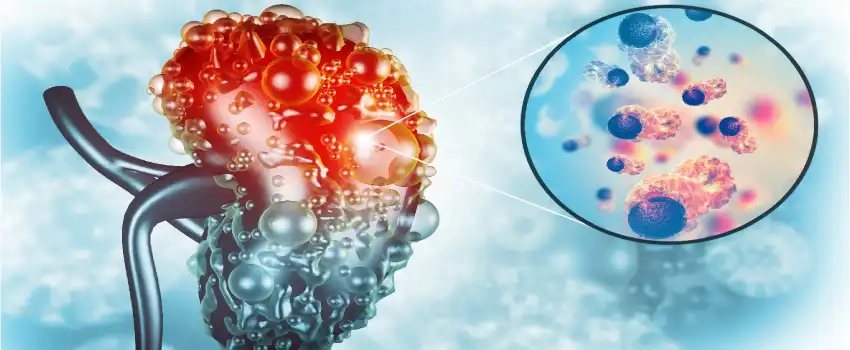 What are the symptoms of kidney problems or disease?