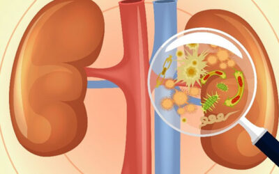 What is a Kidney Infection? What are the causes and how are kidney infections treated?