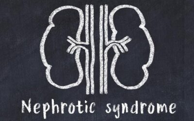 Fluid Insights: What Can You Learn About Nephrotic Syndrome?