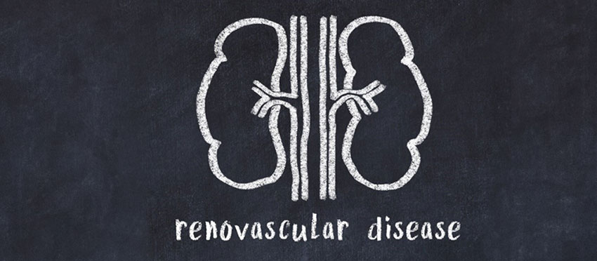 Diagnosing Renovascular-Disease