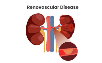 Understanding Renovascular Disease: A Comprehensive Overview