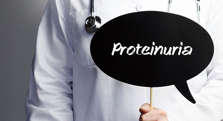 Unraveling the Enigma of Proteinuria: A Deep Dive into Its Connection with Kidney Disease