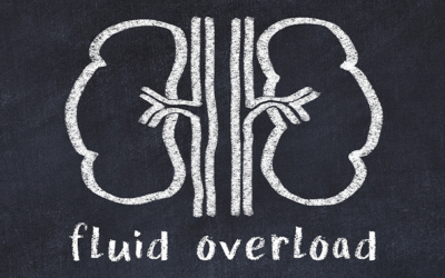 Understanding Hypervolemia: Symptoms, Causes, Diagnosis, and Management