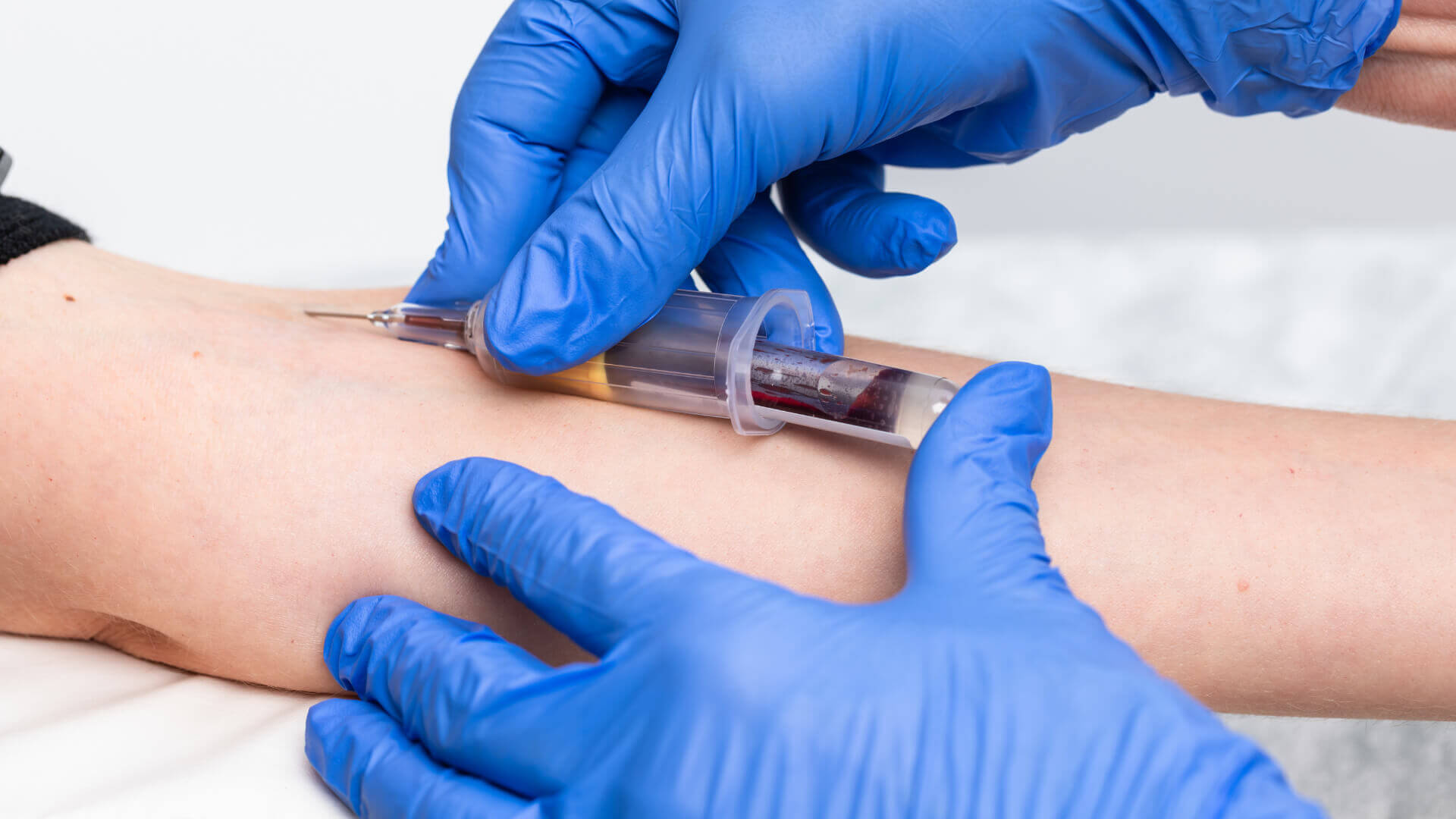 Blood Extraction Image