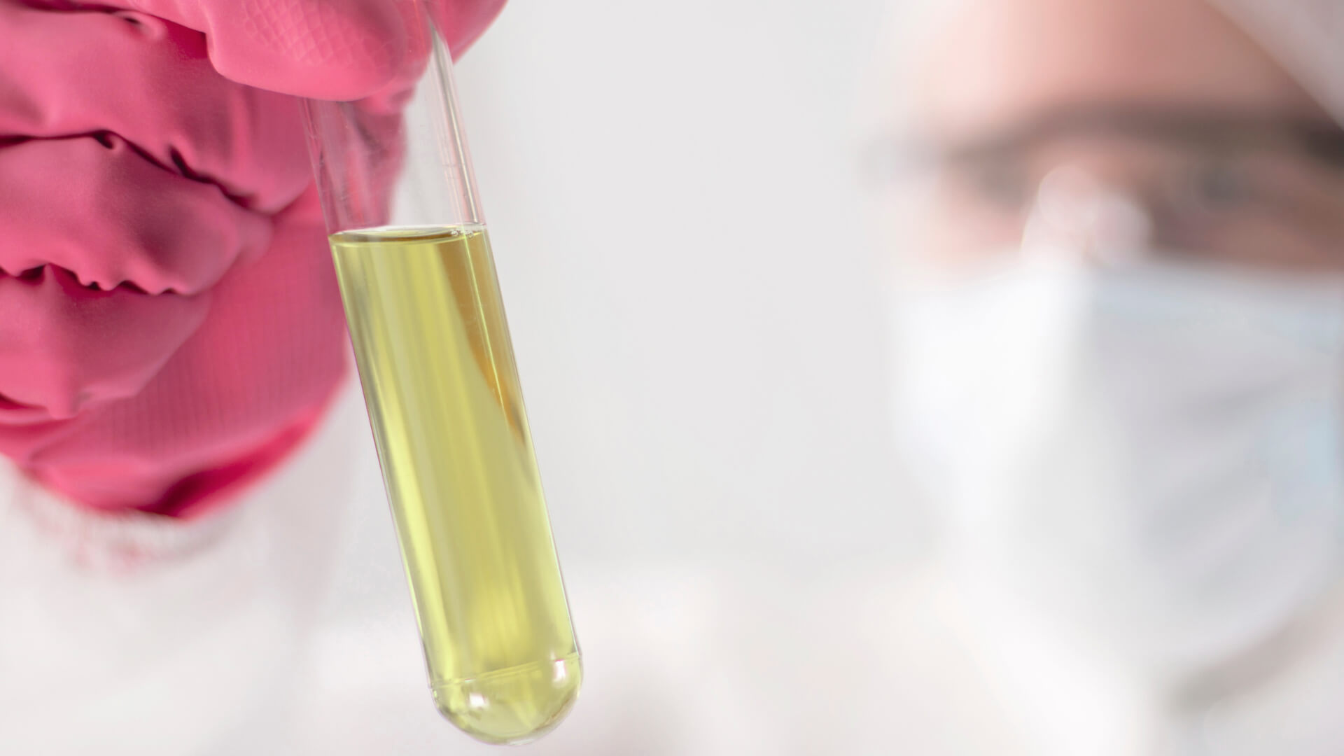 Specialist Watching Urine Vial Image