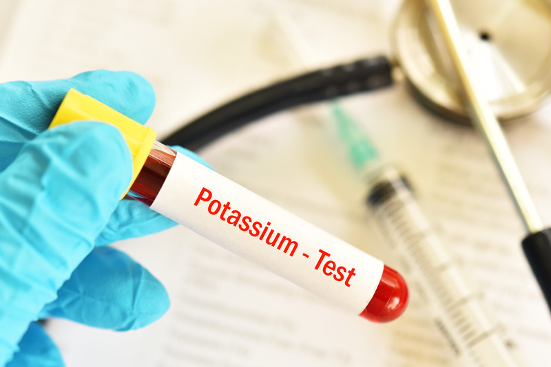 Potassium test